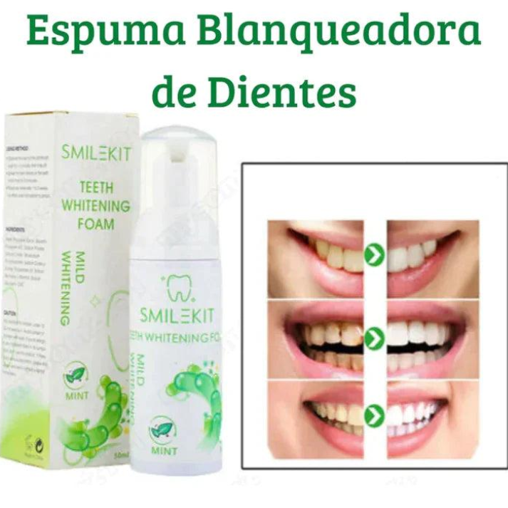 Radiant White™-Sonrisa perfecta